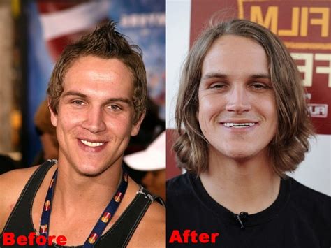 jason mewes dentures